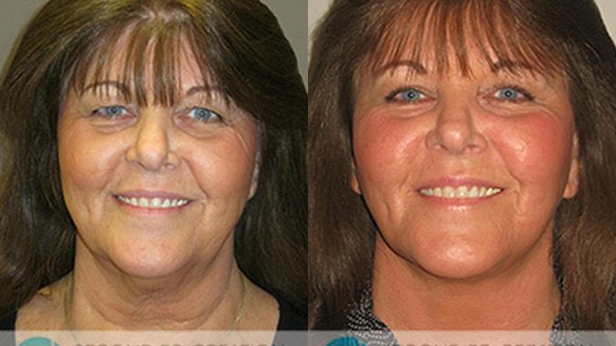 Theresa (Dr. Machida) Before & After
