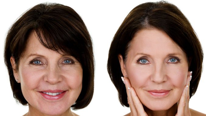 Before & After FF - iStock