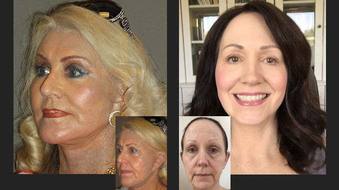 surgeon angeles plastic Facial los Adult Images 2020 And multiple girl bondage